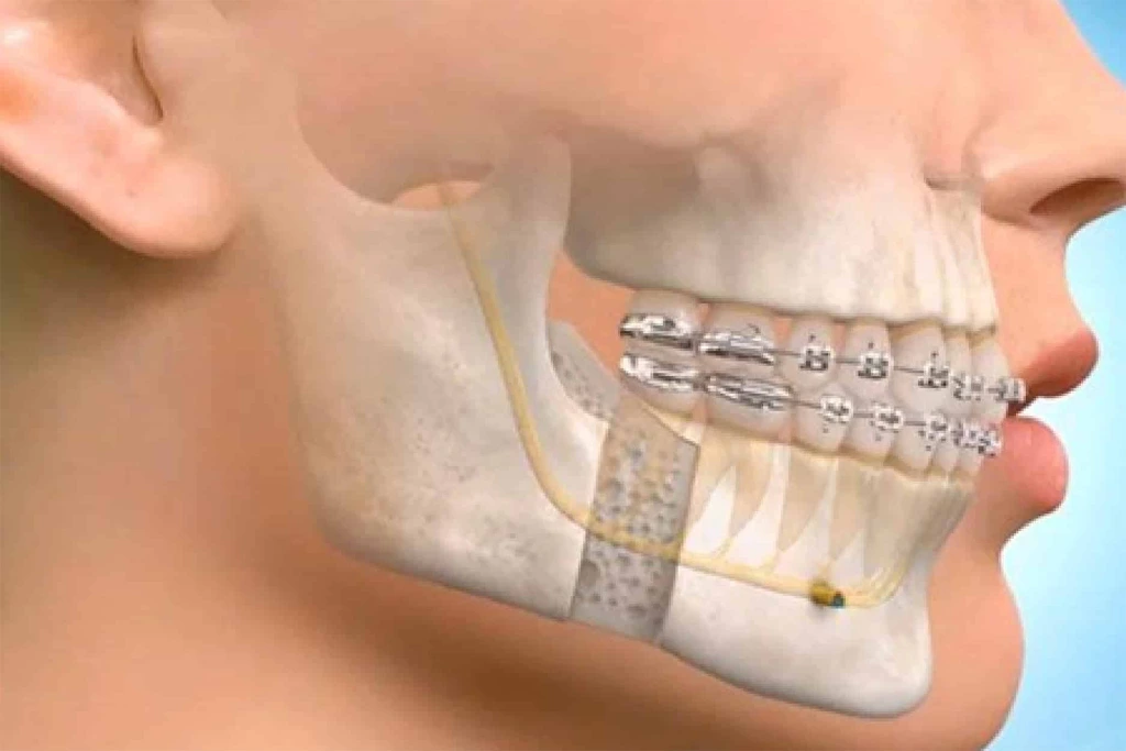 Oral Surgery