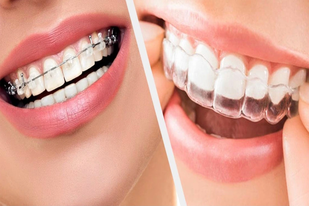 Orthodontics