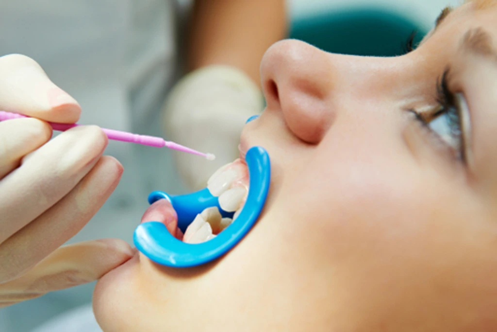 Preventive Dentistry